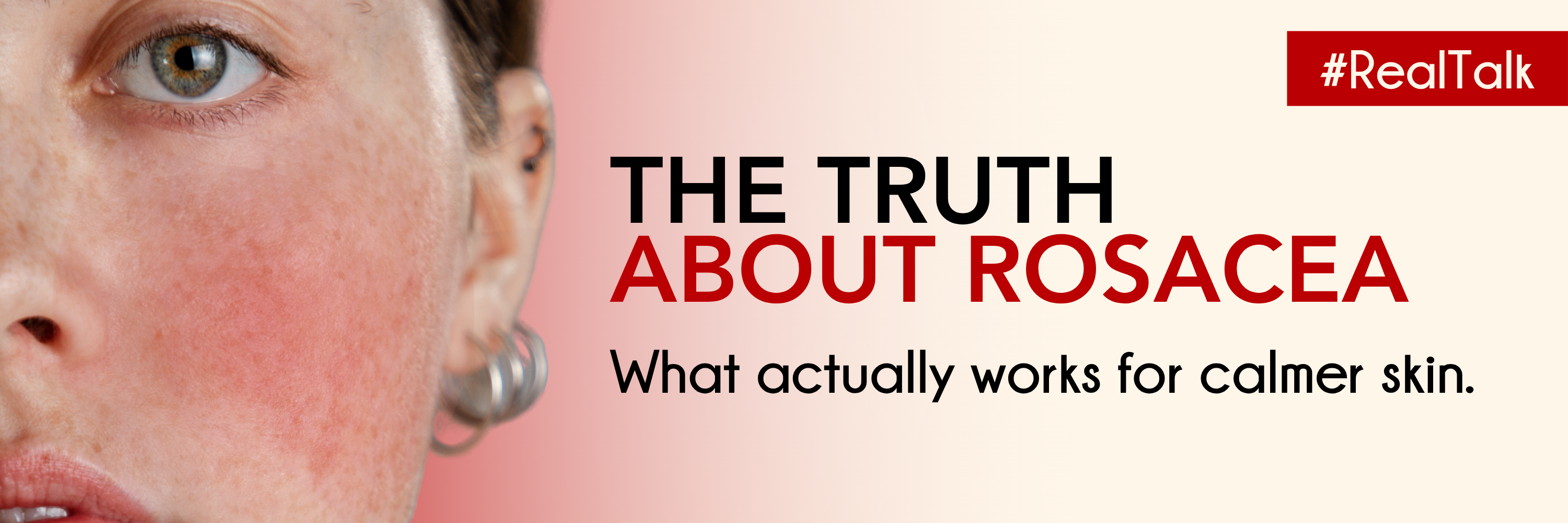 Confused by rosacea advice? Discover what actually works, from identifying triggers to building a gentle skincare routine that supports calm, balanced skin.