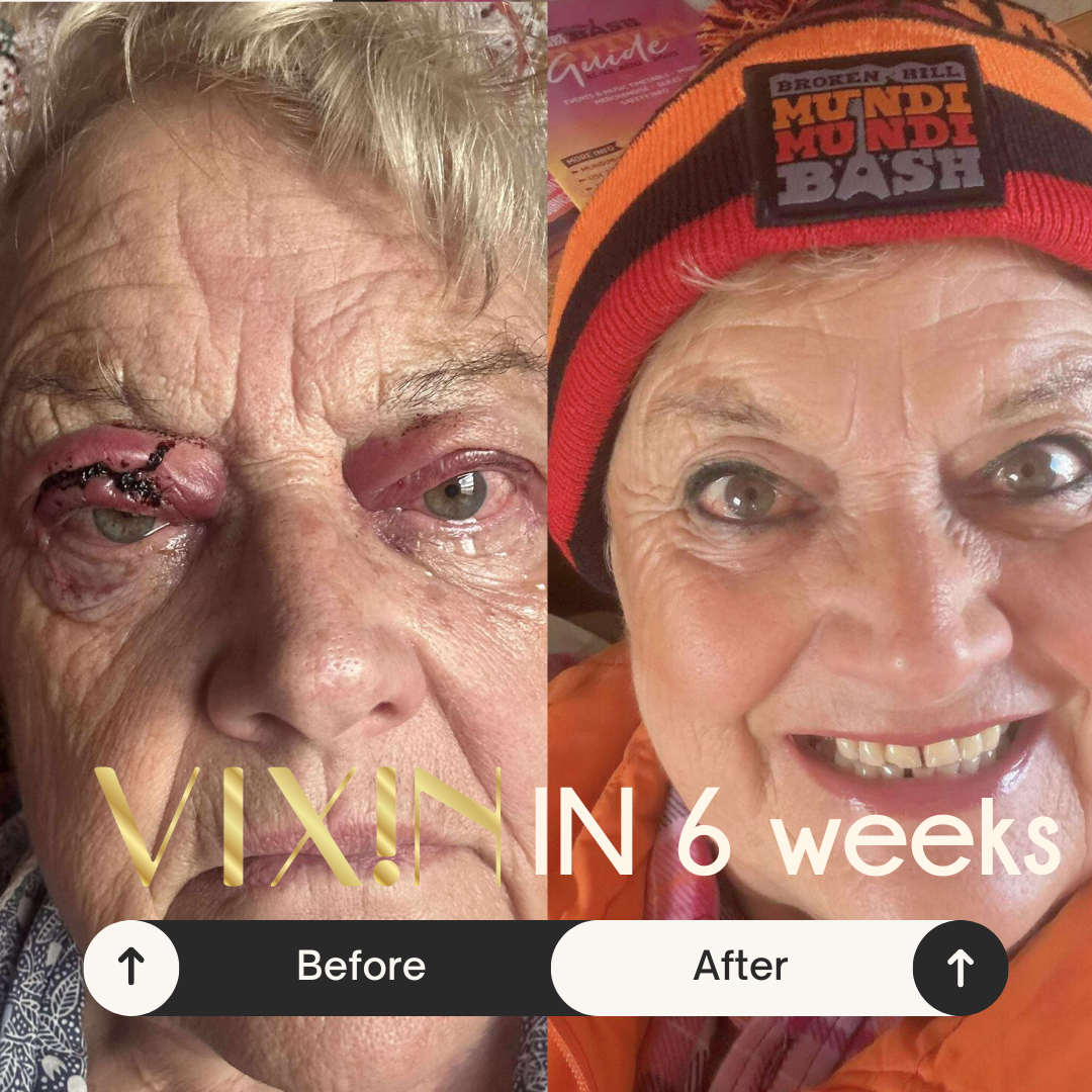 Before and after transformation of a person with visible changes, featuring text 'VIXIN' and 'IN 6 weeks'.