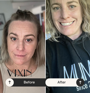 Vixin All In One Apple Stem Cell Face Cream 50mL – certified Australian made moisturiser Before and after