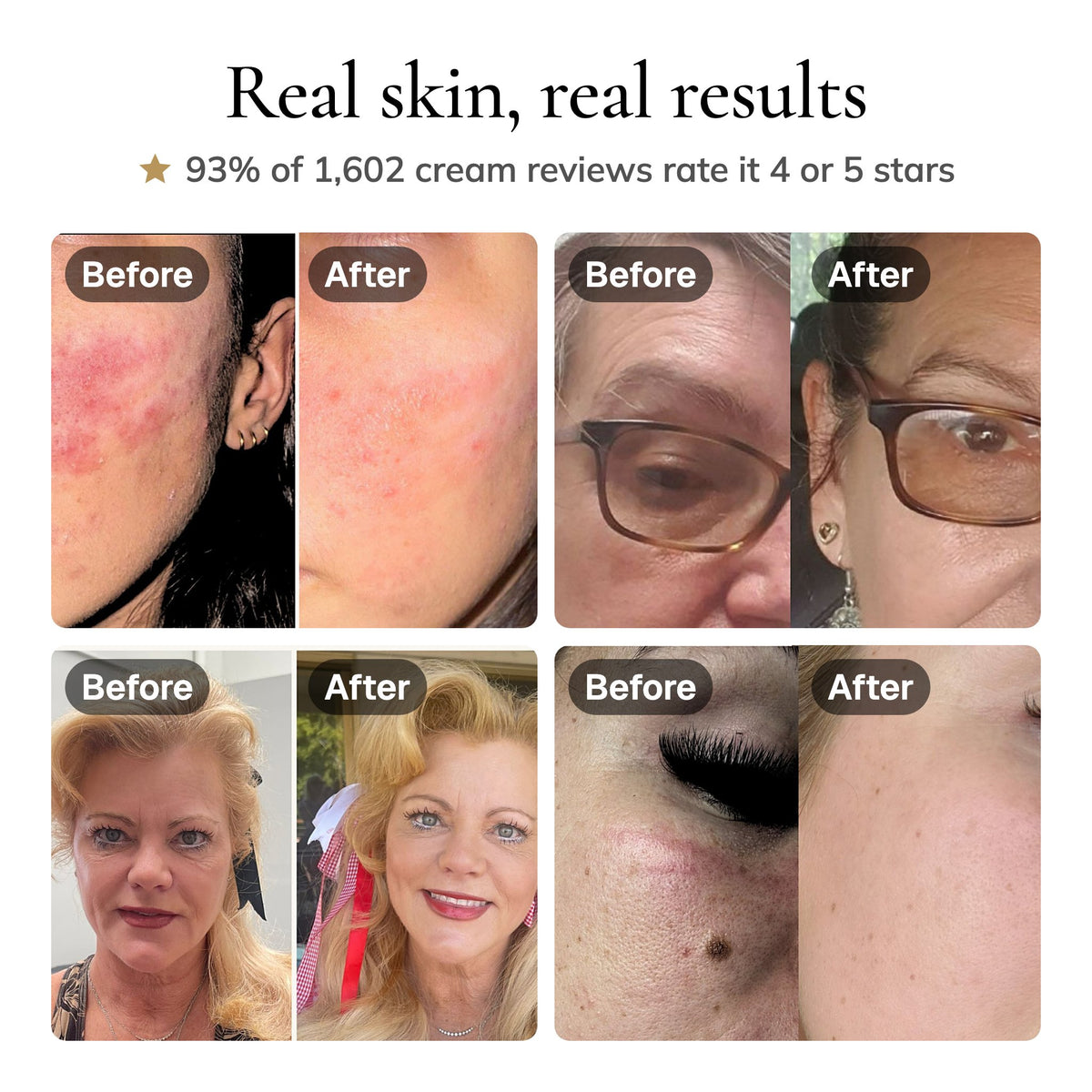 Four customer before and after photos. 93% of 1,602 cream reviews rate it 4 or 5 stars